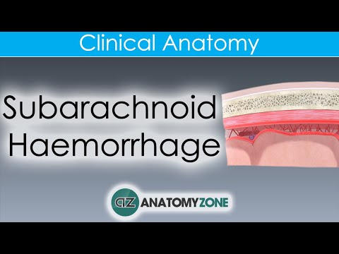 What is Subarachnoid Haemorrhage? | Clinical Anatomy