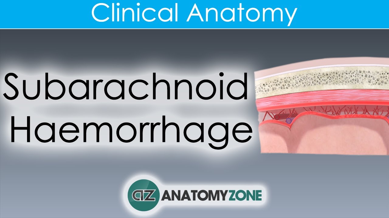 What is Subarachnoid Haemorrhage? | Clinical Anatomy
