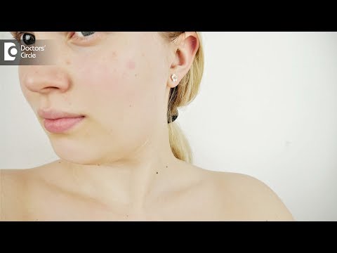 Tips to get rid of open pores in face naturally - Dr. Mini Nair