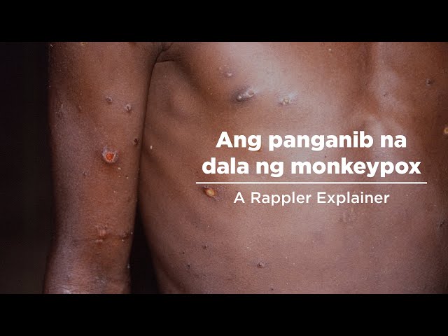 PANOORIN: Ang panganib na dala ng monkeypox