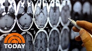 Genetics Determine About Half Of A Person's Predisposition To Addiction | TODAY