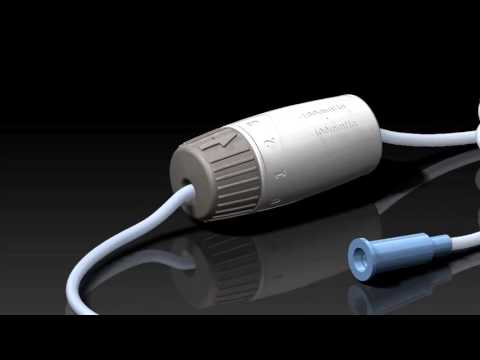Buffalo Filter's PlumePort® ActiV® Laparoscopic Plume Filtration Device