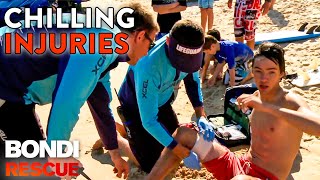 Chilling Injuries from Season 7 of Bondi Rescue