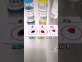 Blood typing Or Blood grouping step by step #laboratory #medtech #medtechstudent #mls #mt #bloodbank
