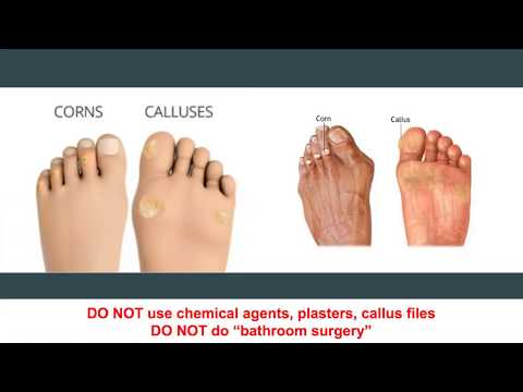 Diabetes Foot Care Guidelines