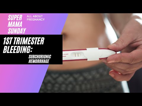 1st Trimester Bleeding: Subchorionic Hemorrhage