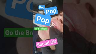 Braces POP! 😲 Satisfying loud pop of Brackets Coming Off | Dr. Dave at Smile Envy Dental #bracesoff