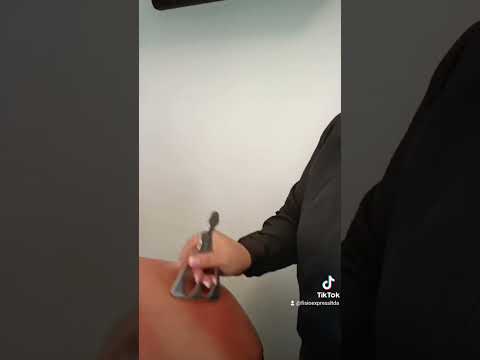 Técnica de liberación miofascial instrumental, efectiva para reducir dolores musculares