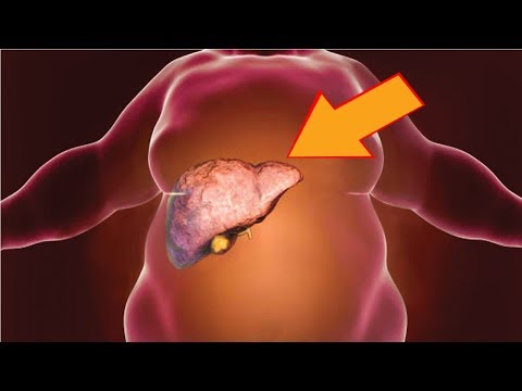 Mawalan ng timbang margaritas sistema queen Kung paano alisin cellulite sa isang linggo sa ang mga binti at ang papa magsanay