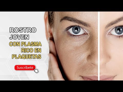 PLASMA RICO EN PLAQUETAS