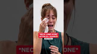 SHE HAD A ‘BIG BALL’ IN HER NECK🤮 #chiropractic #backpain #neckpain #trending