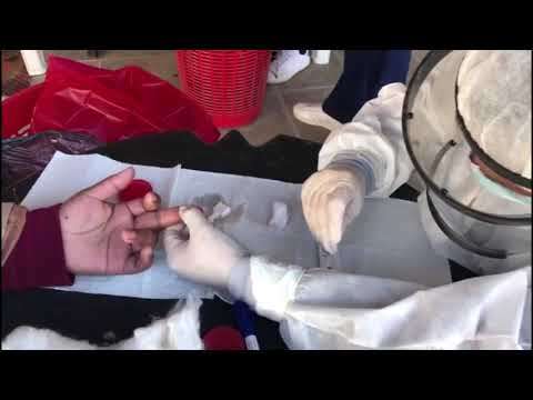 En Vaqueros el Gobernador supervisó el operativo DETECTAR