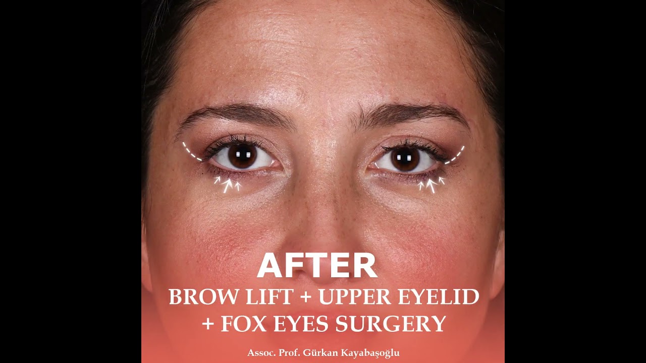 Dr Gurkan Kayabasouglu Plastic Surgeon in Istanbul, Turkey