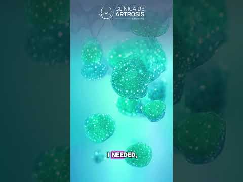 Stem Cell Therapy for Knee Osteoarthritis in Medellin, Colombia: A Life-Changing Patient Success Story