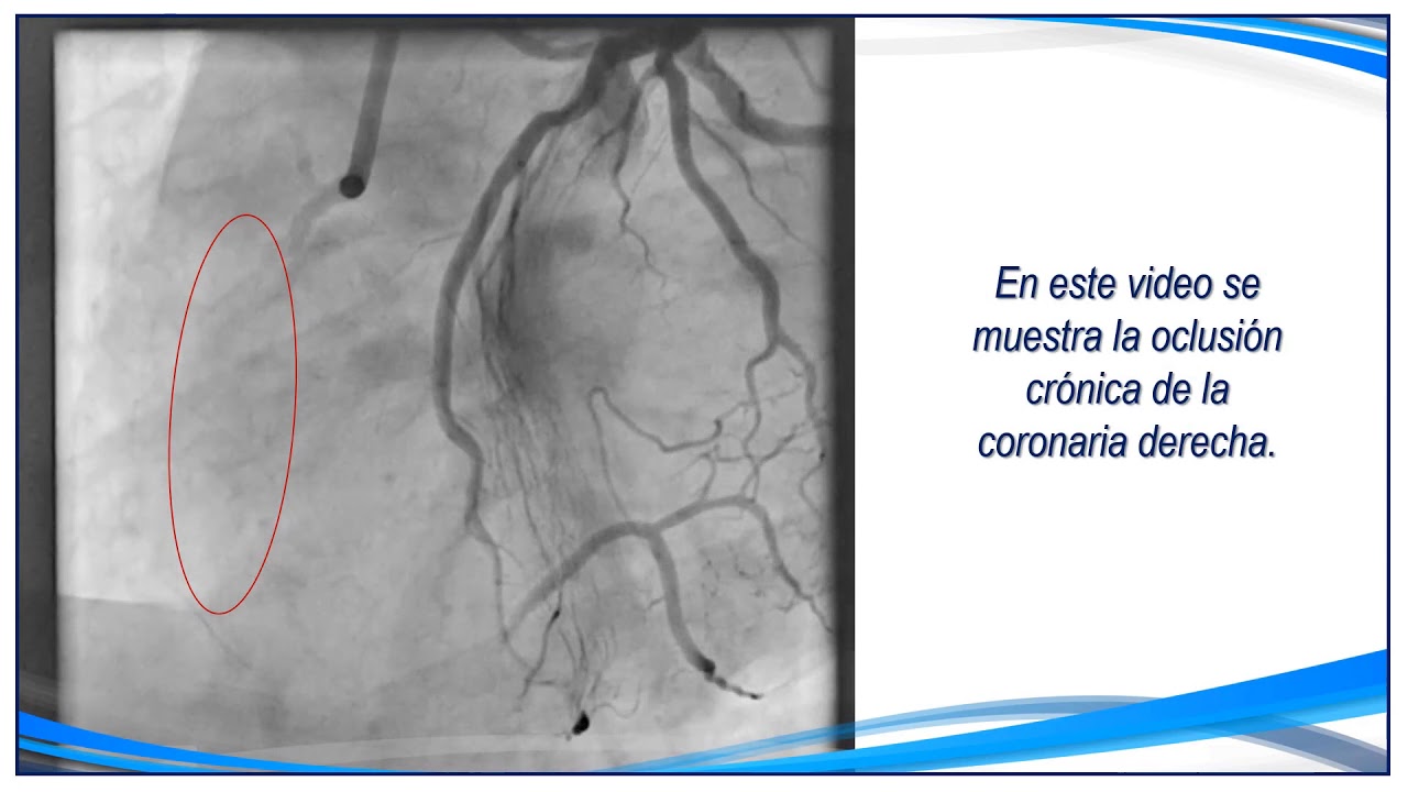 Carlos Alberto Aguirre Molina-16