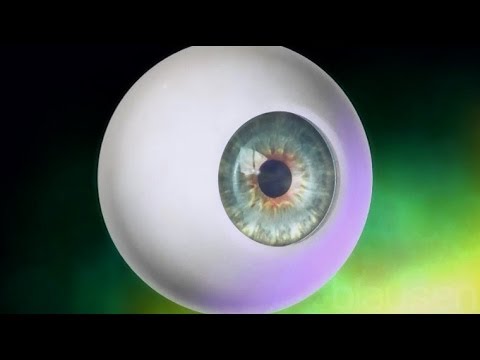 Glaucoma Animation