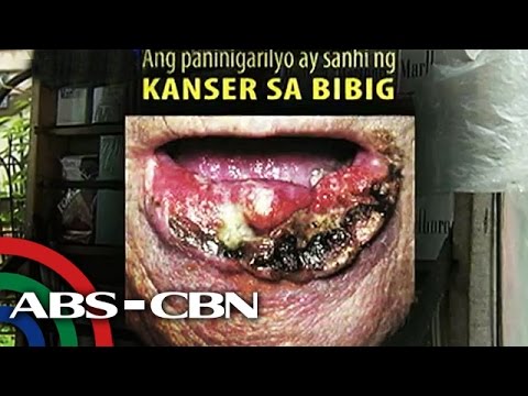 Upang mawala ang timbang sa pamamagitan ng 5 kg trabaho Bumili sa St. Petersburg complex Mawalan ng Timbang sa isang Linggo