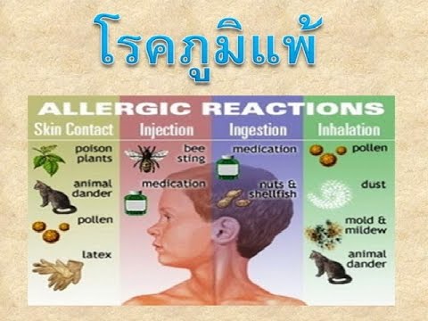 ทนทุกข์ทรมานจากโรคสะเก็ดเงินกรอส ฉันจะได้รับโรคสะเก็ดเงิน