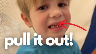 Mild Autism with Loose Tooth | Will the Tooth Fairy Come?