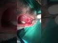 video thumbnail (6)