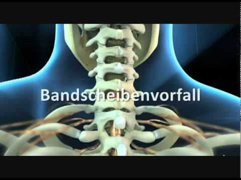 Wenn nach einem Monat Bauchschmerzen und den unteren Rücken Begradigung der thorakalen Lordose