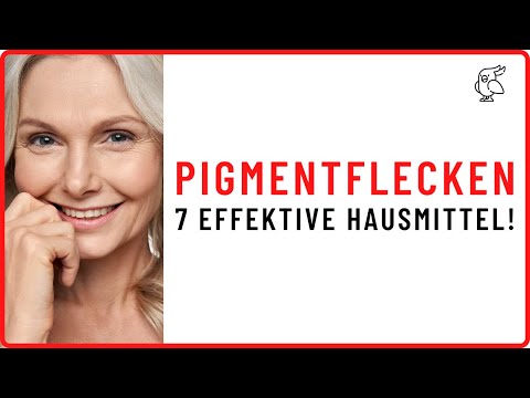 ✅7 HAUSMITTEL DIE PIGMENTFLECKEN IM GESICHT ENTFERNEN✅ Was hilft wirklich bei Pigmentflecken?