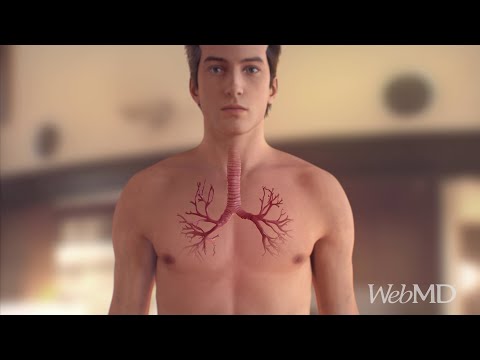 What Severe Asthma Looks Like | WebMD