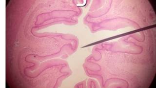 Trial exam for luminal slides (2)