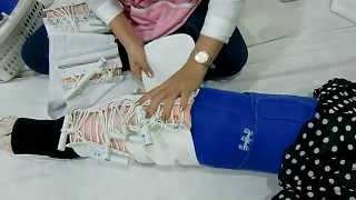 Twisting Tourniquet Technique for Lymphedema Management วิธีขันชะเนาะบำบัดโรคบวมน้ำเหลือง