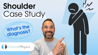 Shoulder Pain Case Study | Specialist Physio explains Assessment, Diagnosis and Clinical Reasoning!