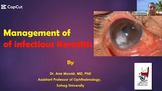 Management of infectious keratitis ..by Dr. Amr Mounir 