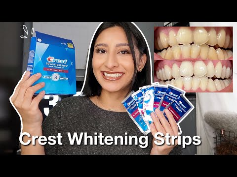 I TRIED THE CREST 3D WHITESTRIPS FOR 14 DAYS *Effective* | Before & After pictures
