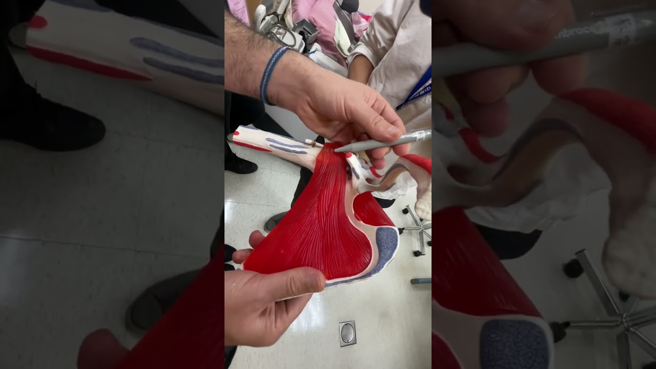 SHAC Block  - Prof. Felice Galluccio @ 8th NMUSIT (Taiwan) by Tsai Tsung-Ying【佑達骨科】【蔡宗穎醫師】 - AI健康醫療影片