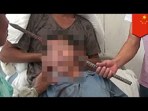 Sopas diyeta na may gulay Upang mawala ang timbang sa 32 kg para sa 2 linggo