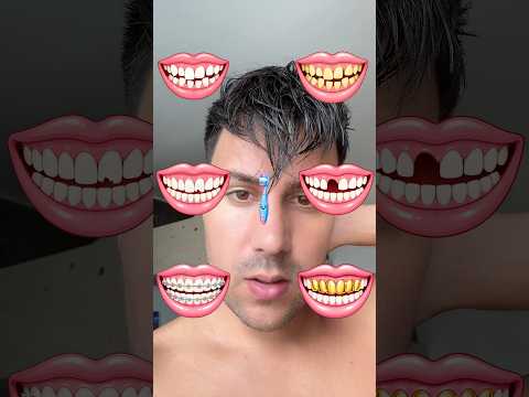 Popravi Zube Challenge 🦷🫣