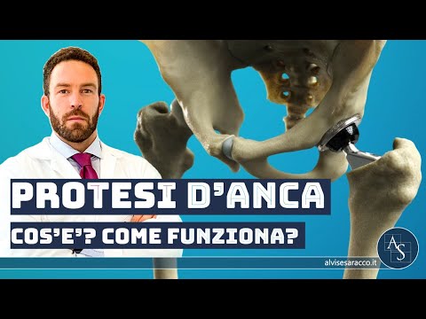 Anteprima video