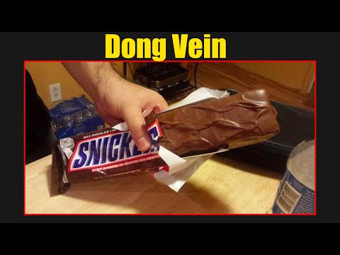 Have Snickers Removed Dong Veins?