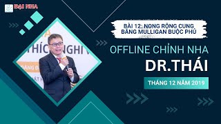 Chỉnh nha offline: Bài 12 Nong rộng cung bằng Mulligan buộc phủ