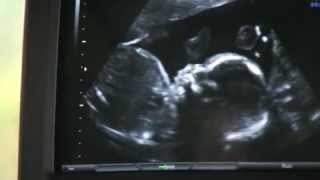 preview picture of video 'Florida Hospital Tampa Bay Division TV ad -- Maternity'