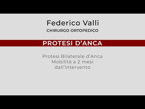 Plazmolifting nel trattamento delle articolazioni artritiche Lo Yoga aiuta il mal di schiena