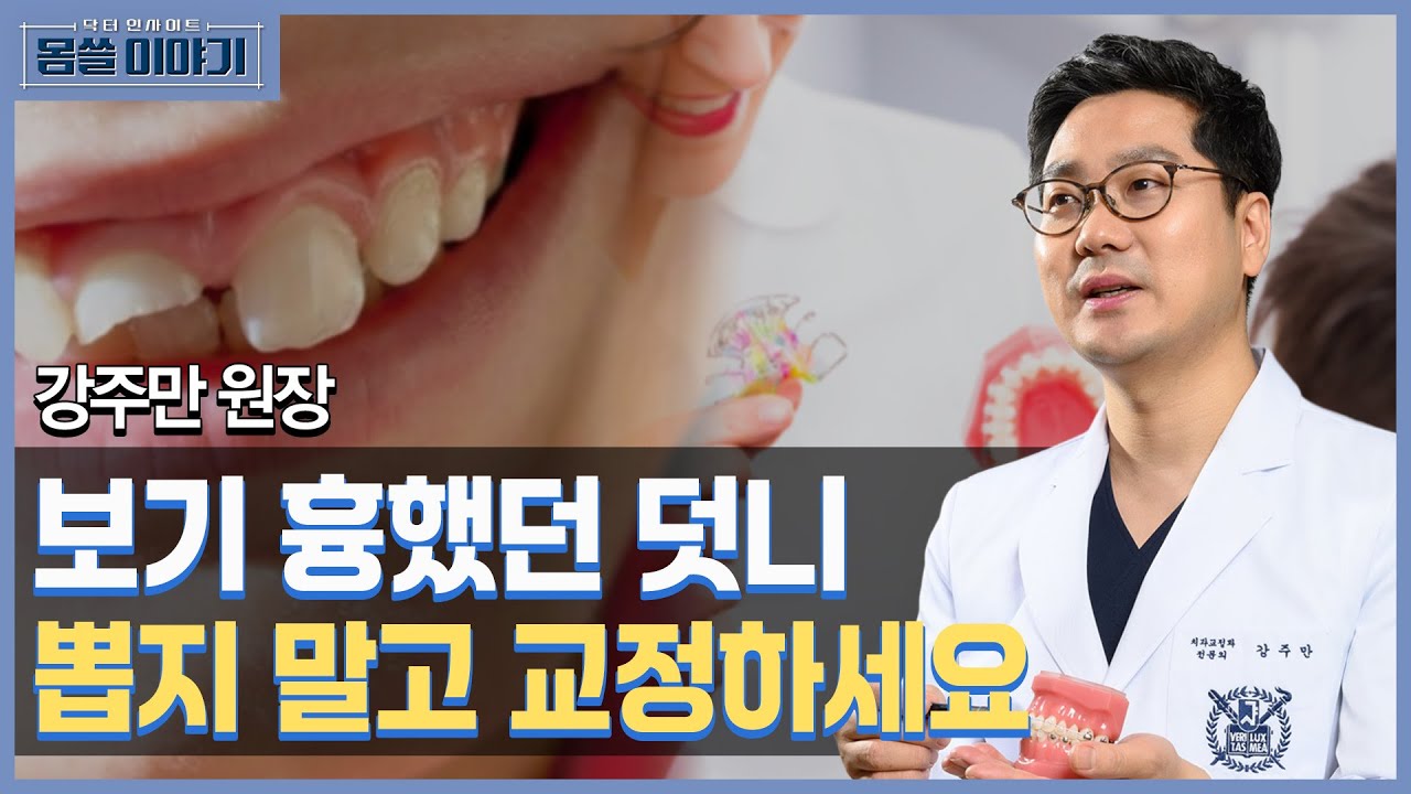 디지털 접목!…덧니 비발치로 정밀하게 교정하자 [몸쓸이야기 6회]