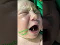 Newborn Teeth |#baby #teeth #newbornteeth #shortsvideo #drpoonammaggo