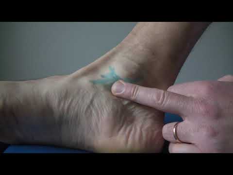 Condroprotectoare pentru artroza articulației genunchiului 3 generații