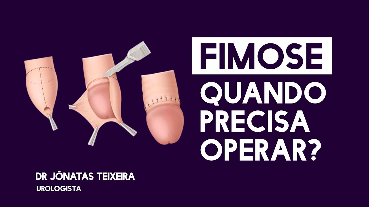 Jonatas Teixeira Santos-8