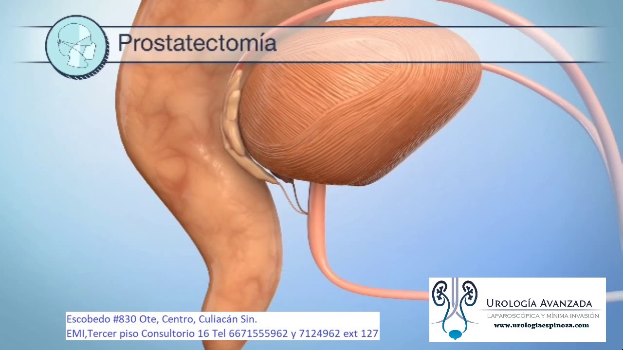 Alejandro Espinoza Guerrero-23