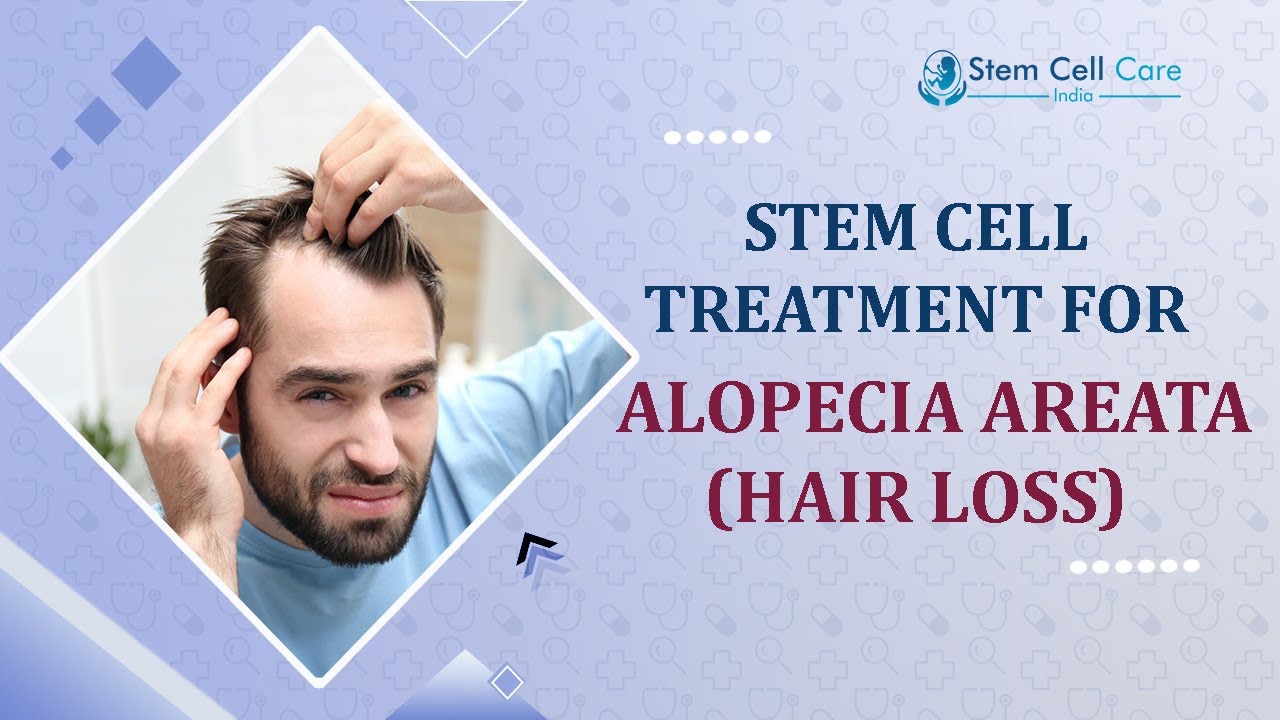 Alopecia Areata is one of the most common T cell-mediated autoimmune | Hair Loss