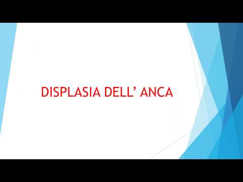 Kapsikam della malattia degenerativa del disco cervicale Da alcun dolore movimento di ritorno