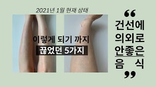 건선에 의외로 나쁜 음식 5 가지