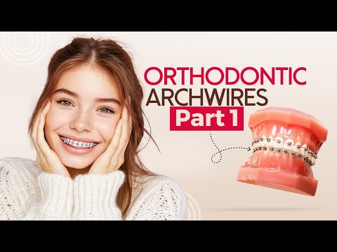 Orthodontic Archwires: Types & Features | Part 1 | Dentalkart