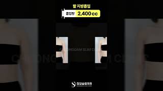 팔뚝살, 조용히 퇴장했습니다. #shorts